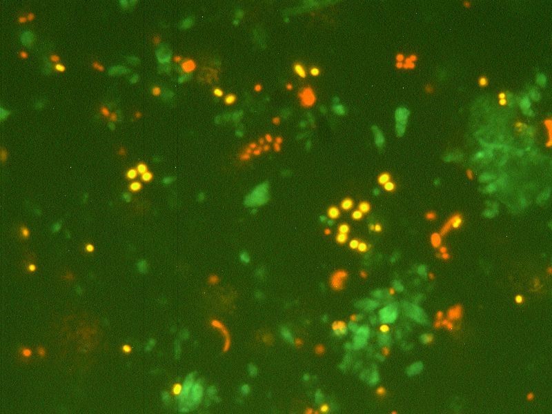 A Balaton legkisebb algáinak fluoreszcens mikroszkópi képe.