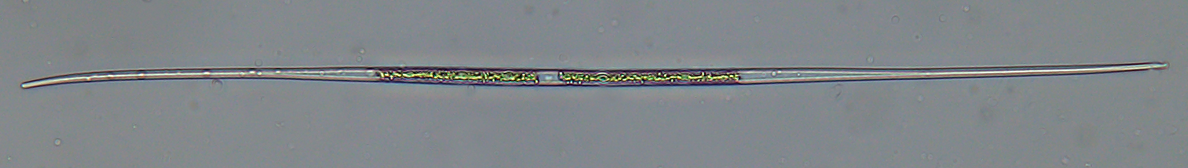 Closterium aciculare zöldalga, mérete kb. 500 x 6 mikrométer. Fénykép: Vörös Lajos