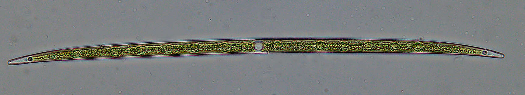 Closterium lineatum zöldalga, mérete kb. 500 x 14 mikrométer. Fénykép: Vörös Lajos