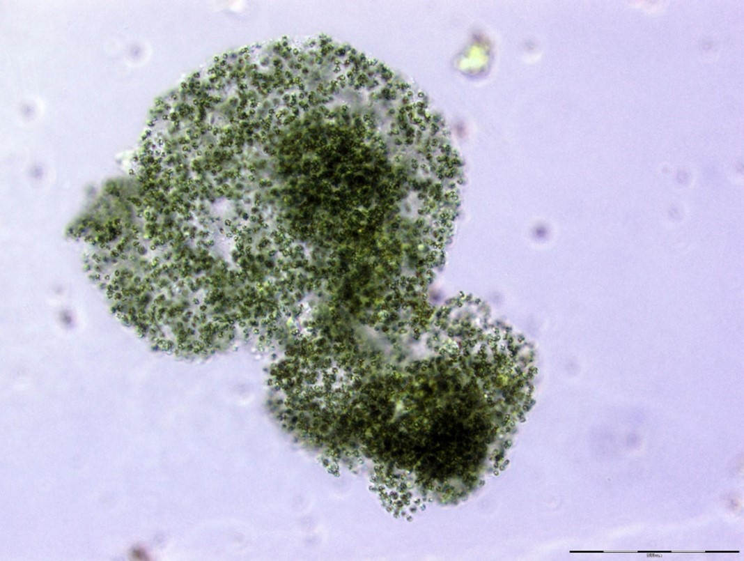 Microcystis flos-aquae kolóniás 