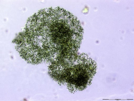 Microcystis flos-aquae kolóniás cianobaktérium, a Balatonon jellemzően a tó középső és keleti területein okozhat lokális algavirágzást