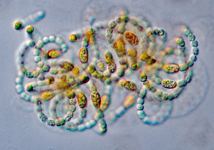 2.	ábra A kora nyári jellegzetes cianobaktérium (Dolichospermum flos-aqaue) mikroszkópi képe a Szigligeti-medencéből.