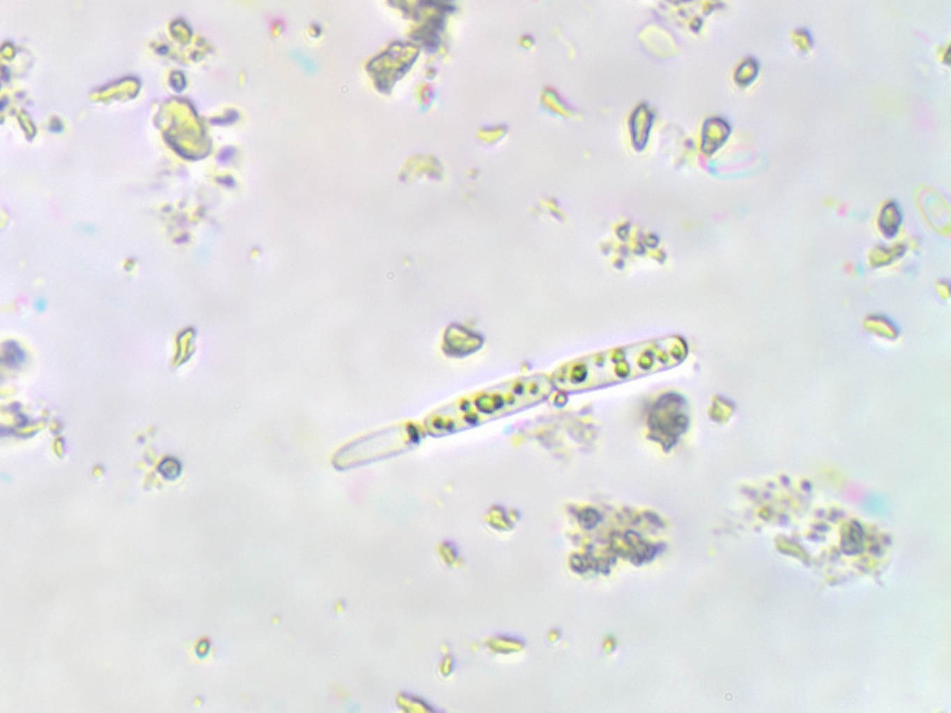 Cianobaktérium (Raphidiopsis raciborskii) kitartó sejtek az üledékben. (Fotó: Kovács Attila)