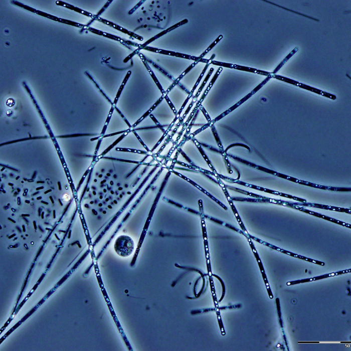alga mikroszkóp alatt Fotó: Somogyi Boglárka
